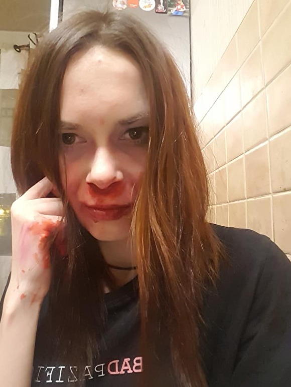 В Екатеринбурге член ОНК Дарья Беляева пожаловалась на избиение