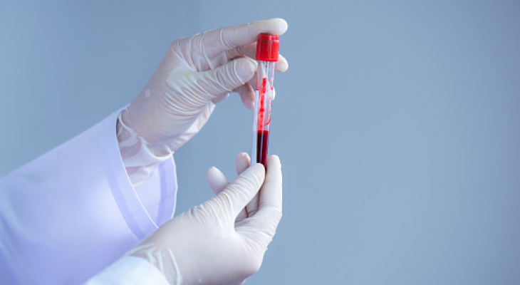 Биолог назвала группу крови, люди с которой реже заражаются омикроном